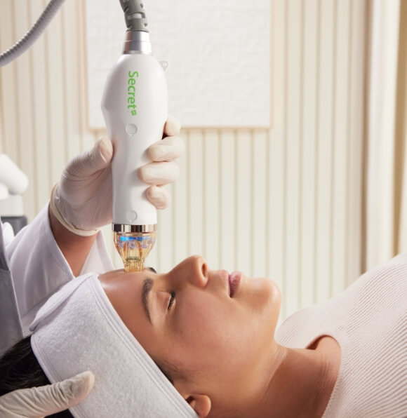 A Cutera treatment being done to the forehead of a patient.