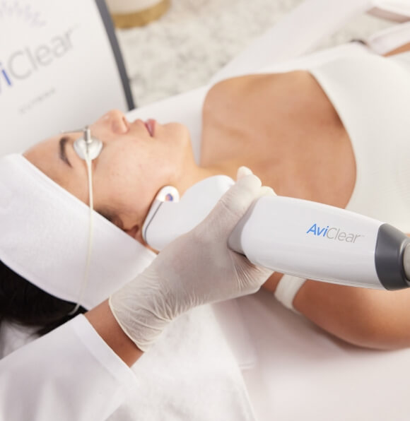 AviClear treatment being done to a patient's lower jawline.